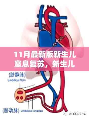 新生儿窒息复苏步骤指南,最新版初学者进阶版(11月版)