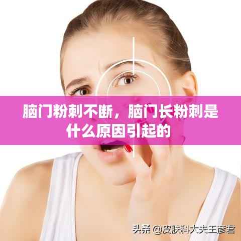 脑门粉刺不断,脑门长粉刺是什么原因引起的