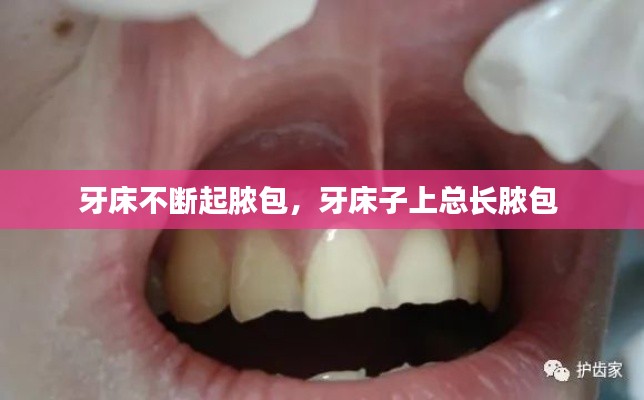 牙床不断起脓包,牙床子上总长脓包